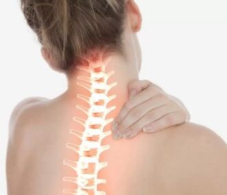 Zervikale Osteochondrose