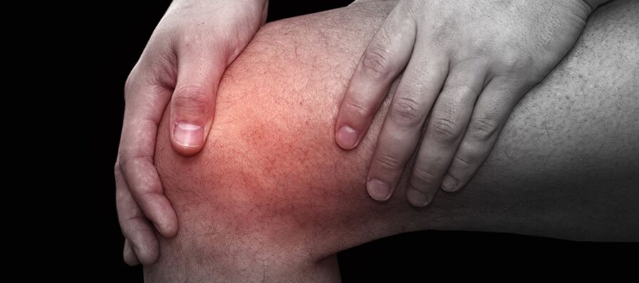 Entzündung und Beschwerden im Knie mit Gonarthrose